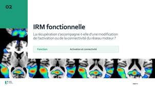 3_MesureChangement_IRMFonctionnelle.mp4