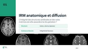 2_MesureChangement_IRMStructurelle.mp4