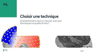 5_MesureChangement_ChoixTechnique.mp4
